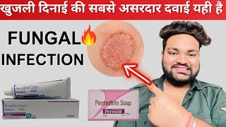 खुजली दीनाई🔥ठीक नहीं हो रहा क्या ये करके देखो Fungal Infection Treatment  Tacroz Cream Review [upl. by Juni489]