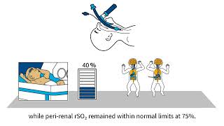 INVOS™ oximetry in the NICU Byte 9 NIRS as a signal of hypocarbiainduced cerebral vasoconstriction [upl. by Strang]