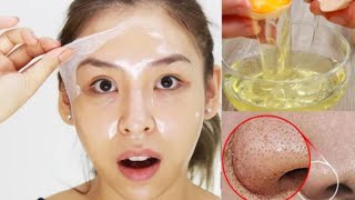 Egg White Face Mask  Diy Face Mask For Loose Skin Skin Tightening amp Open Pores 🌿 [upl. by Lalat]