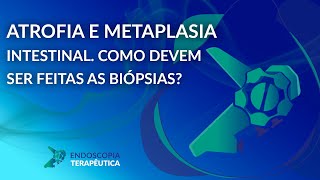 Atrofia e metaplasia intestinal como devem ser feitas as biópsias [upl. by Upton962]