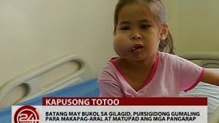 Batang may bukol sa gilagid pursigidong gumaling para makapagaral at matupad ang mga pangarap [upl. by Us637]