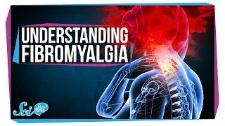 Real Pain and Explosive Brains  Fibromyalgia [upl. by Satsoc]