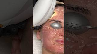 ASMR Laser Treatment [upl. by Ona]