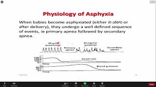 Pediatric Lecture on Perinatal Asphyxia Part 2 [upl. by Amal783]