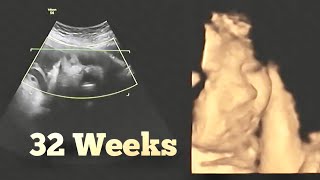 Ultrasound at 32 Week Pregnant  8 months Pregnancy Growth Scan [upl. by Gorrian577]