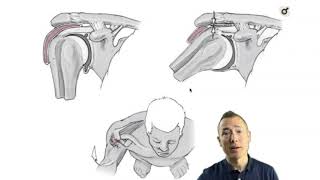 Scapular Dyskinesis  ChiroUp [upl. by Perlie]