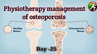 Day  25  Physiotherapy management of Osteoporosis  Osteoporosis management [upl. by Tekcirc]