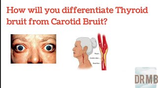 Difference between Thyroid Bruit and Carotid Bruit  How to differentiate Dr M B [upl. by Adnolor675]