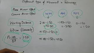 Different types of movement in Retinoscopy [upl. by Kos865]
