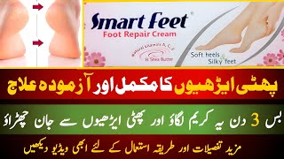 Smart Feet Foot Repair Cream  Best Treatment For Dry Feet  Heel Repair Cream [upl. by Stefania]