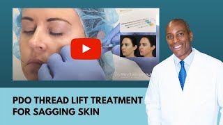 PDO Thread Lift Treatment for Sagging Skin in the Lower Face I RevitalizeMaui [upl. by Nonnah]