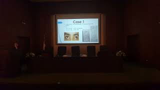 Exotropia case presentation Dr Yara Fathi [upl. by Eward51]