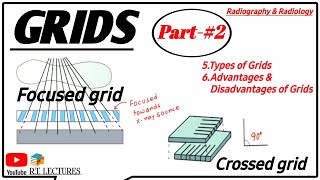 Grids in Radiology Part 2  AntiScatter Grid  Grid used in radiologyBRTBRIT and DRTDRIT [upl. by Babcock]