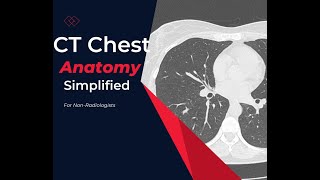 CT chest Anatomy Made simple For Medical students residents and clinicians [upl. by Omoj]