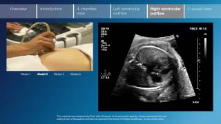 Key screening views of the fetal heart  Part 5  Right ventricular outflow [upl. by Eletnahs]