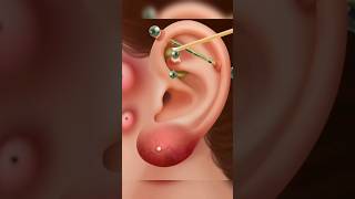 Ear Cleaning ASMR asmr trending youtubeshorts animation earwaxremoval [upl. by Anilegna819]