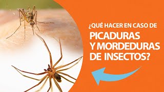 ¿Qué hacer en caso de picaduras y mordeduras de insectos [upl. by Krid195]