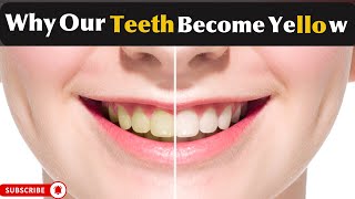 Why does our teeth turn to Yellow Yellow Teeth  Teeth yellowness and discoloration  MHCP [upl. by Anitsyrhk411]