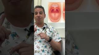 Herpes virus  gingivoestomatitis [upl. by Niltag]