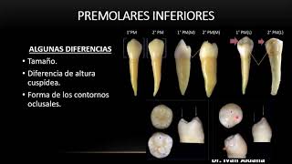 ANATOMÍA DENTARIA Unidad 25 Premolares inferiores Segundo premolar inferior parte 2 [upl. by Giffard]