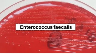 Enterococcus faecalis Colony Morphology on CLED Agar [upl. by Eniar521]