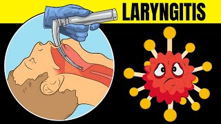 Laryngitis Acute amp Chronic  Causes Signs amp Symptoms Diagnosis And Treatment [upl. by Heymann479]