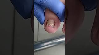 Satisfying Pedicure Video pedicure toenails [upl. by Stetson970]