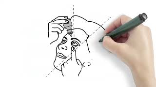 How to Apply Eye Drops [upl. by Adnohsak]