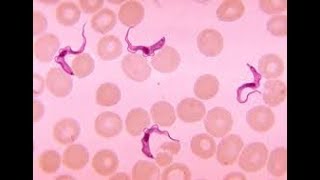 Trypanosomaamp Protozoaاسهل طريقة لشرح التريبانوسوما [upl. by Essirahc]