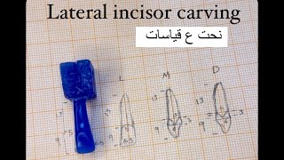 Maxillary lateral incisor [upl. by Tracee]