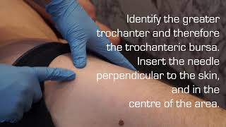 Injection Technique of the Trochanteric Bursa for Bursitis [upl. by Llerraj]