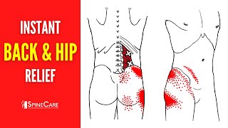 How to Fix Hip and Back Pain on One Side [upl. by Allana150]