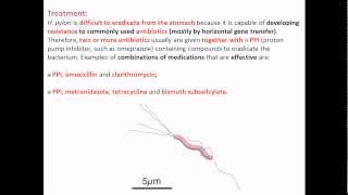 Helicobacter pylori treatment [upl. by Tallbot410]