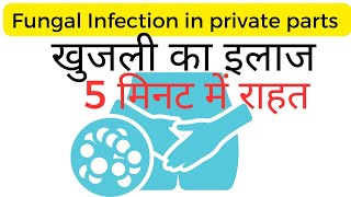 Fungal infection in private parts home remedy in Hindi [upl. by Map]