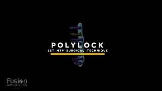 PolyLock MTP Surgical Technique [upl. by Ayekin863]