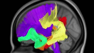 Major white matter pathways of the brain [upl. by Moscow869]