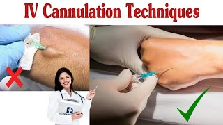 How To Insert IV Cannula  IV Cannulation Techniques [upl. by Nawj]