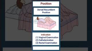 Dorsal Recumbent Position [upl. by Kepner]