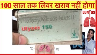 Ulyses 150mg Tablet Full Information In Hindi  Uses  Side effects  Dosage [upl. by Nekcarb277]