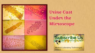 Urine CastTypes and Causes urinanalysis [upl. by Nies]