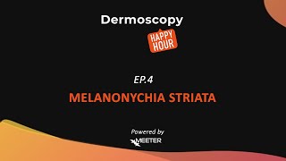 Dermoscopy Happy Hour  SEASON 2 EPISODE 4 quotMELANONYCHIA STRIATAquot [upl. by Previdi]