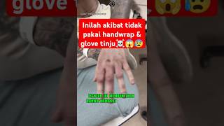 Jgn coba² gk pake glove klo GK mau kek gini ☠️😰 boxing boxingskill fight mma bangghalyh [upl. by Kaazi]