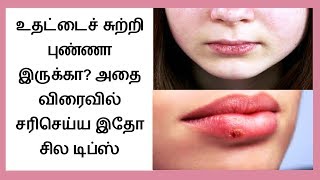 How to Get Rid of Dry Chapped Lips in tamil  Chapped Lips Remedy │Tamil Dear [upl. by Smoht]