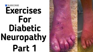 Exercises for peripheral neuropathyperipheral neuropathy exercises for feetPhysiotherapyTreatments [upl. by Tnahsarp]