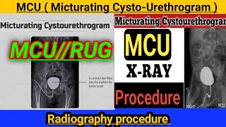 MCU  Micturating CystoUrethrogram   xray RGU and MCU  MCU test in Hindi radiography 2023 [upl. by Zelde]