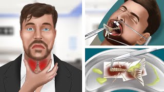 ASMR Animation Help MrBeast remove fish bones stuck in his throat [upl. by Cortie]