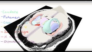 Basal Ganglia 3D Tour [upl. by Oeflein]