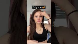 Oily test boys Vs girls 🪔🥰 oilyface shorts youtubeshorts [upl. by Sitto]