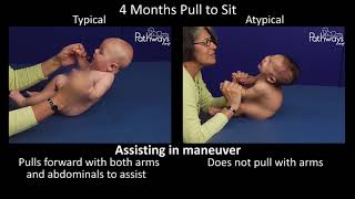 4 Month Old Baby Typical amp Atypical Development Side by Side [upl. by Adaurd]