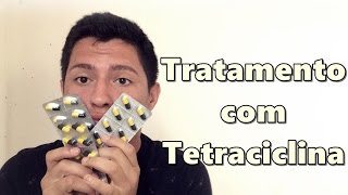 COMEÇANDO TRATAMENTO PARA ACNE COM TETRACICLINA  Tonzão Tivi [upl. by Tiana]